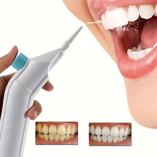 Portable Cordless Tooth Flosser & Oral Irrigator, No Batteries, Travel-Friendly, Ideal Gift for Men & Women